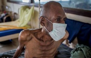 ۳۰ درصد کودکان جهان سوءتغذیه شدید دارند/ ۴۱ میلیون نفر در معرض خطر قحطی هستند